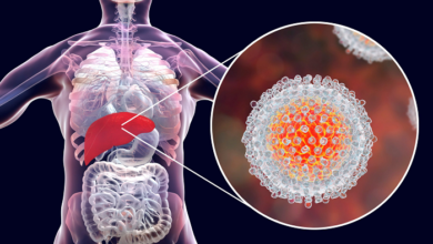Hepatitis C puede ser curable con diagnóstico oportuno y tratamiento adecuado￼
