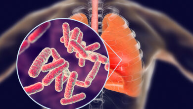Habrá tertulia virtual por el Día Mundial de la Tuberculosis