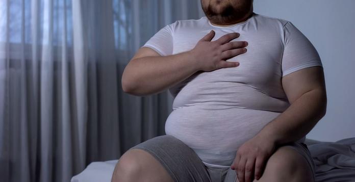 Personas con sobrepeso y obesidad deben tener mayor cuidado ante el Covid-19
