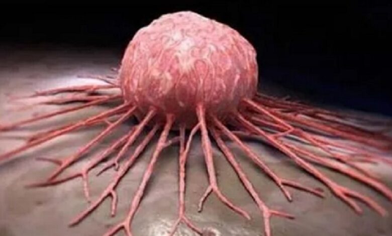 Cáncer, de las amenazas más graves de la salud global para la OMS