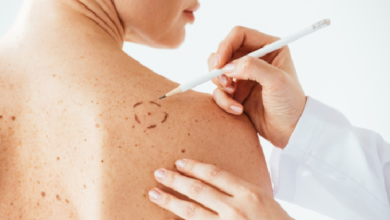 Con procedimiento mínimamente incisivo, IMSS logra curar el cáncer de piel