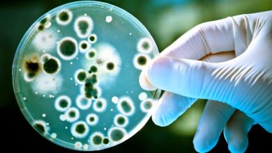 ¿De qué depende que las bacterias resistan a antimicrobianos?