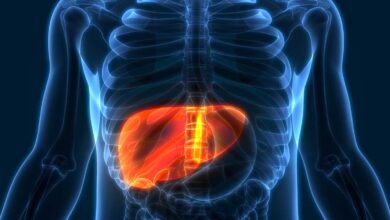 ¿Qué es el hígado graso?