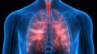 ¿Qué tanto sabes de la hipertensión pulmonar?