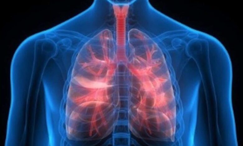 ¿Qué tanto sabes de la hipertensión pulmonar?