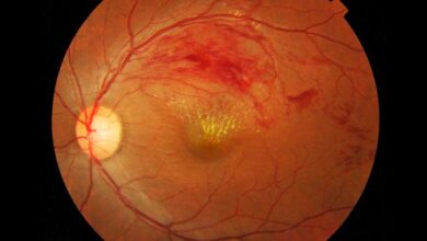 Células madre podrían regenerar retinas