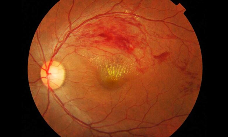 Células madre podrían regenerar retinas