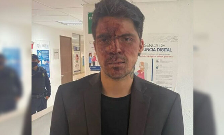 Video: César D’Alessio denuncia que fue golpeado por el priista Arturo Montiel