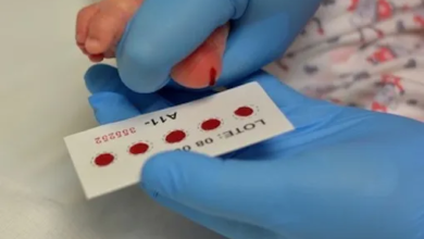 Fibrosis quística, enfermedad detectable con la prueba de tamiz neonatal