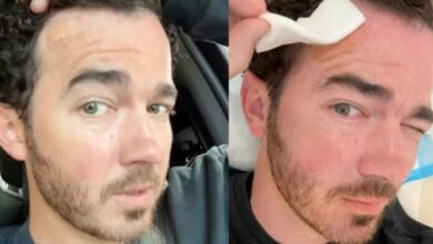 Kevin Jonas revela que le detectaron cáncer de piel