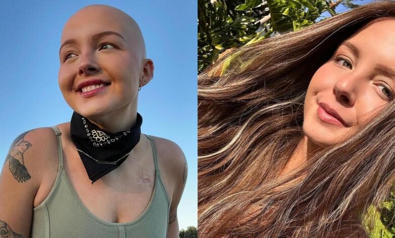 Muere Maddy Baloy, tras mostrar su lucha contra el cáncer